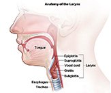 Larynx Cancer